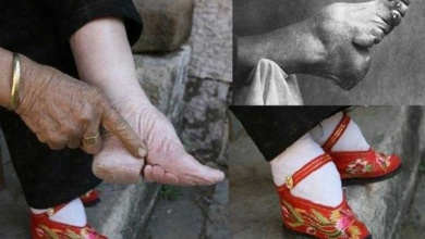 Pés-de-lótus: Confira fotos chocantes da antiga tradição chinesa