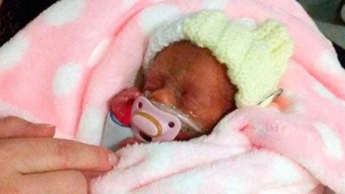 Médicos presenciam milagre ao ver recém-nascida de apenas 450 gramas respirar sem ajuda de aparelhos