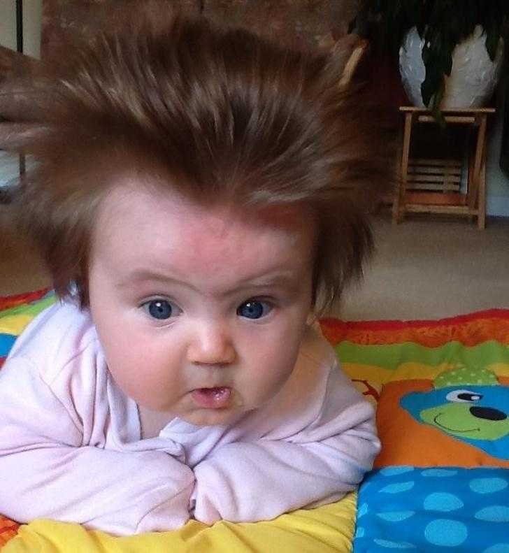 Pais compartilham fotos de bebês cabeludos viram sucesso na internet
