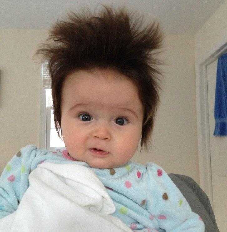 Pais compartilham fotos de bebês cabeludos viram sucesso na internet