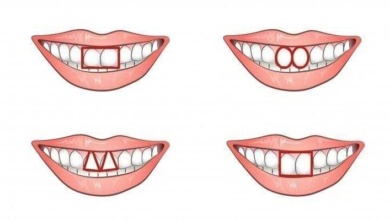 O formato dos dentes da frente revela muito sobre a sua personalidade