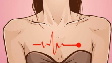 O infarto se manifesta de maneira diferente nas mulheres