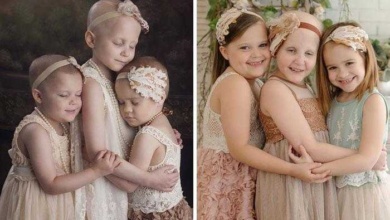 10 antes e depois de pessoas que venceram o câncer e recomeçaram a vida