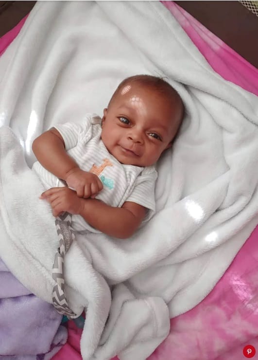 Pai mostra bebê 3 meses após ter sido derrubada pelo médico ao nascer