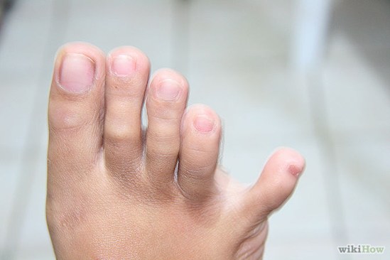 Capacidade para separar o dedo mínimo do pé
