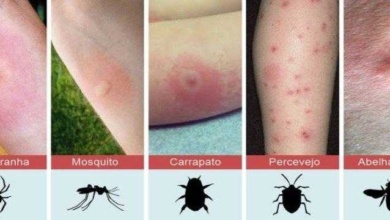 Aprenda a identificar 10 picadas perigosas de insetos