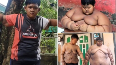 Menino mais gordo do mundo, que pesava 190 quilos, passa por incrível transformação