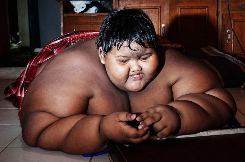 Menino mais gordo do mundo, que pesava 190 quilos, passa por incrível transformação
